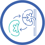 Kidney Transplant