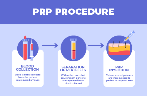 Erectile Dysfunction & PRP Therapy: A Modern, Effective Solution for Men