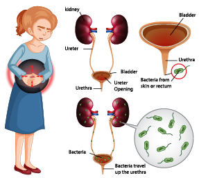 UTI Treatment in Ahmedabad