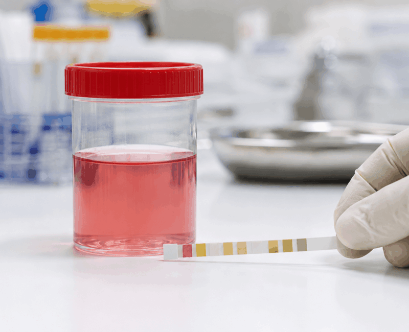 Symptoms of Kidney Cancer Symptoms of Kidney Cancer