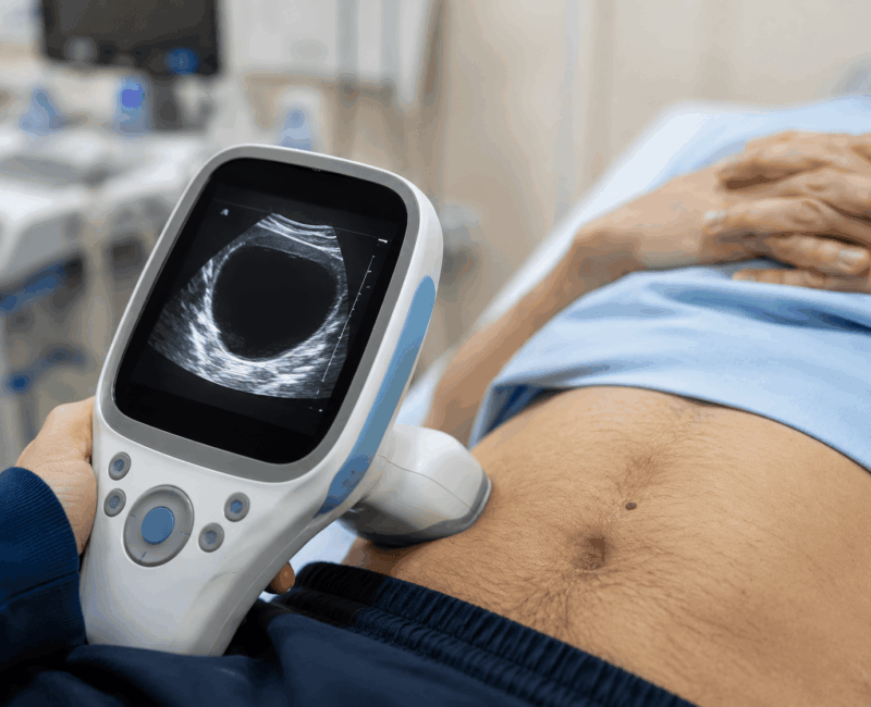 Symptoms of Urinary Retention Symptoms of Urinary Retention