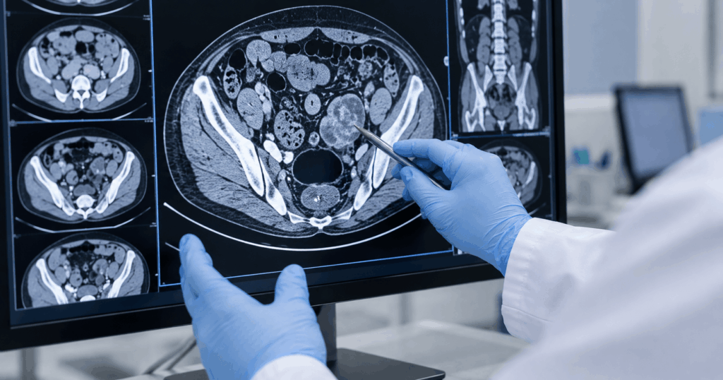 Testicular Cancer Clinic in Ahmedabad — Expert Diagnosis & Treatment by Dr. Prarthan Joshi