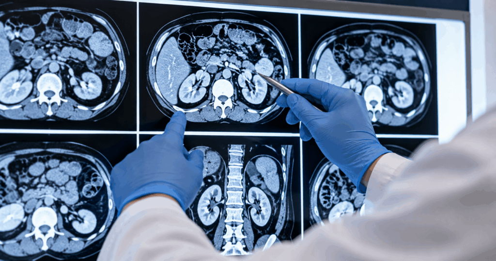 Testicular Cancer Clinic in Ahmedabad — Expert Diagnosis & Treatment by Dr. Prarthan Joshi